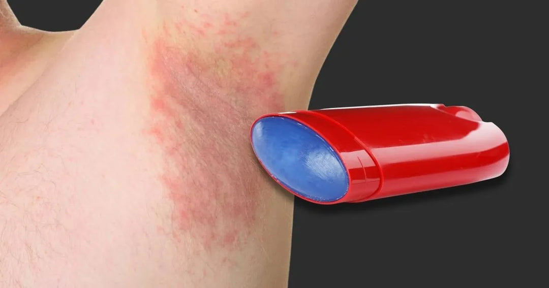 Dermatitis en axilas, estas son las causas más comunes