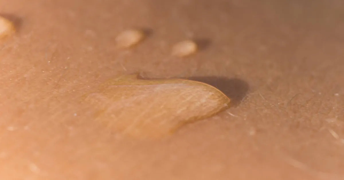 piel grasa deshidratada