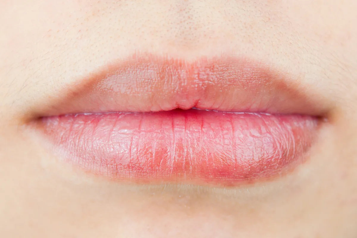 balsamo para labios partidos