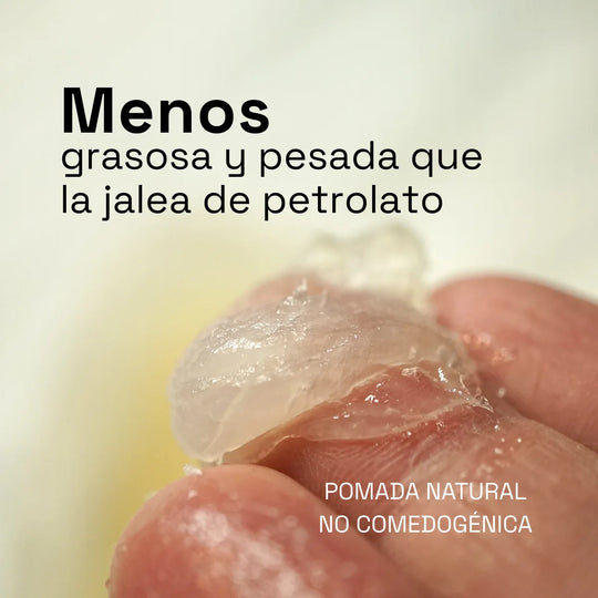 pomada natural no comedogenica y ligera